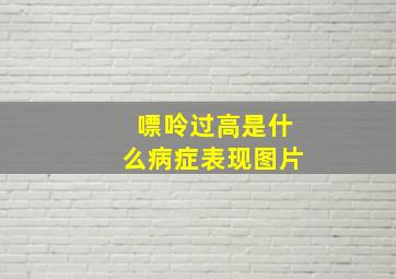 嘌呤过高是什么病症表现图片