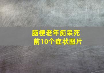 脑梗老年痴呆死前10个症状图片